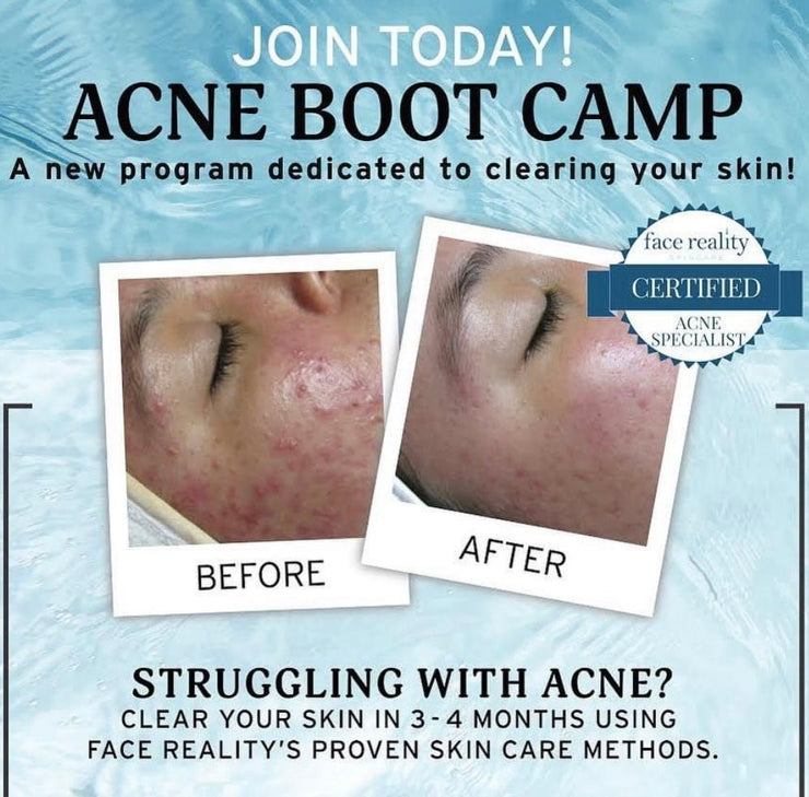 Face Reality Acne Bootcamp in Orlando - Skinne Face and Body Care